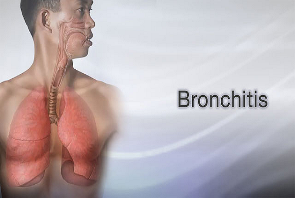 Acute and Chronic Bronchitis