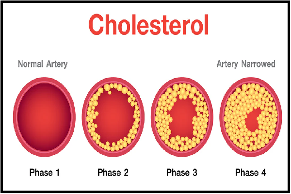 Cholesterol